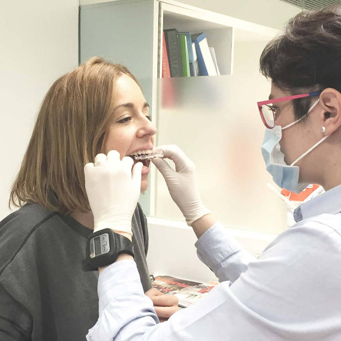Ortodoncia invisible en paciente