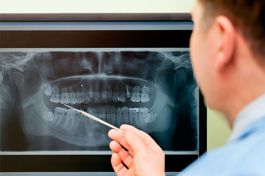 Radiografía para cirugía oral