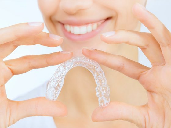 Tipos de ortodoncia Invisalign