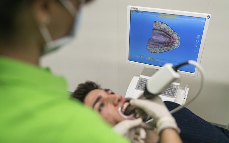 Escaneado intraoral