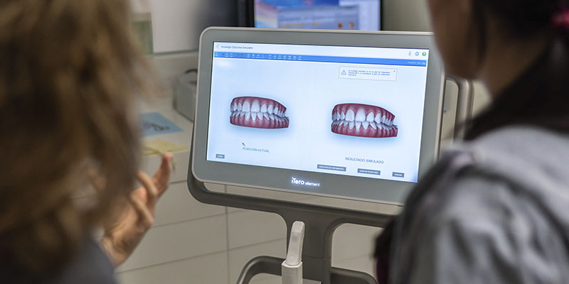 Incorporación del escáner intraoral iTero Elements y del escáner 3D Sirona