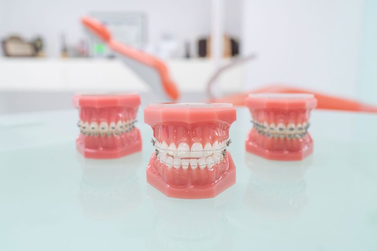 brackets transparentes