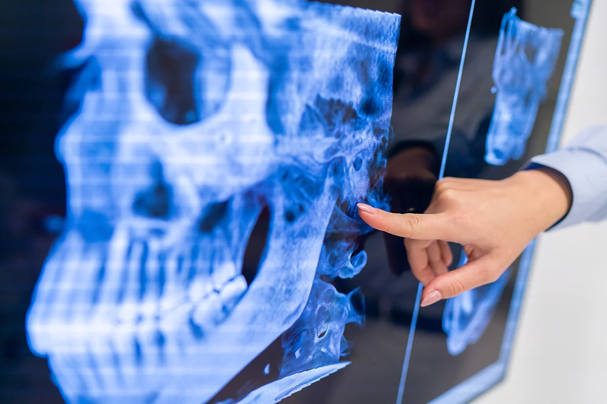 Radiografías digitalizadas​