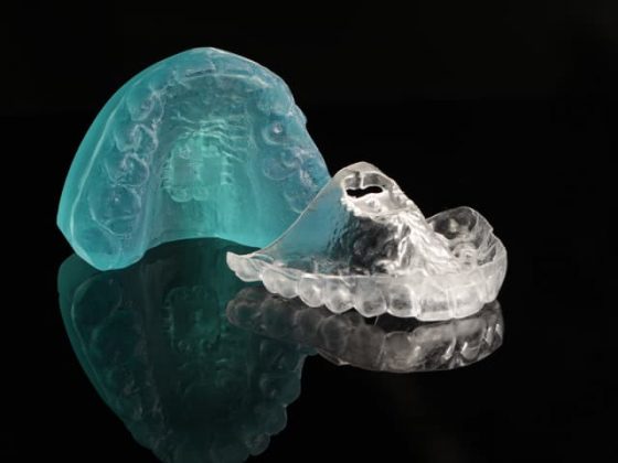 tecnica marpe instrumento expansor paladar adultos